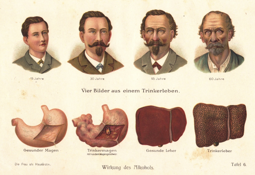 Die Hilfe beim Alkoholrausch die mehrtägige Sauferei